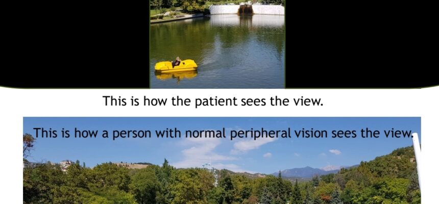 What is the visual defect shown on the picture?