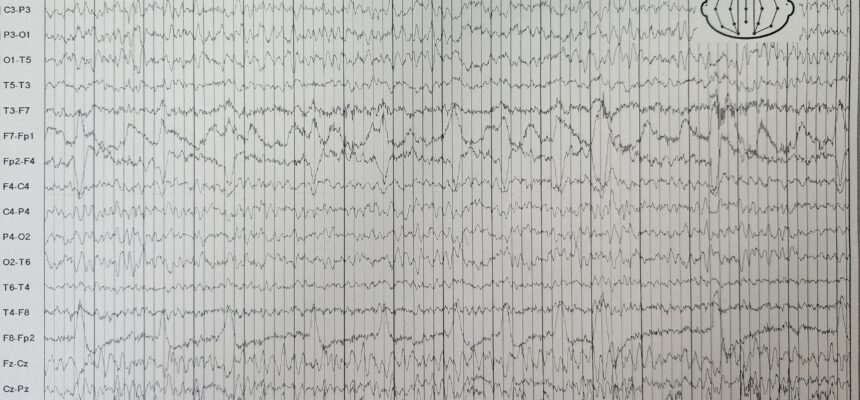 Q 1.32. Electroencephalography (EEG)